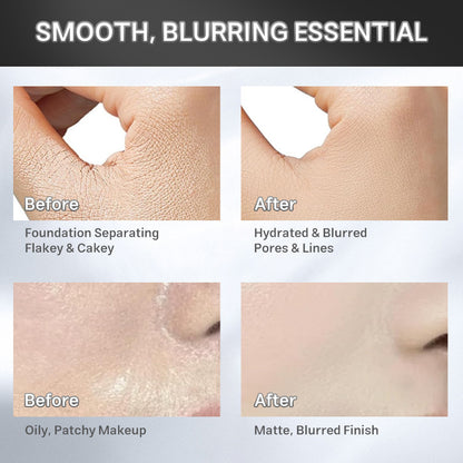 The Skin Eraser